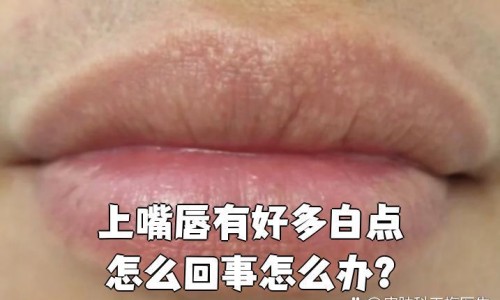经期可以吃冰糖雪梨汤吗-月经期间可以吃冰糖煮梨吗网—知名的姨妈期能吃冰糖炖雪梨吗网站,分享经期能吃冰糖炖雪梨吗知识